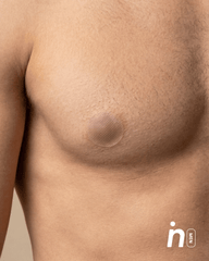Kit Cubrepezones Pareja: Anti - Roce (Él) + Sin Adhesivo (Ella) - Nipskin® - Nipskin ES