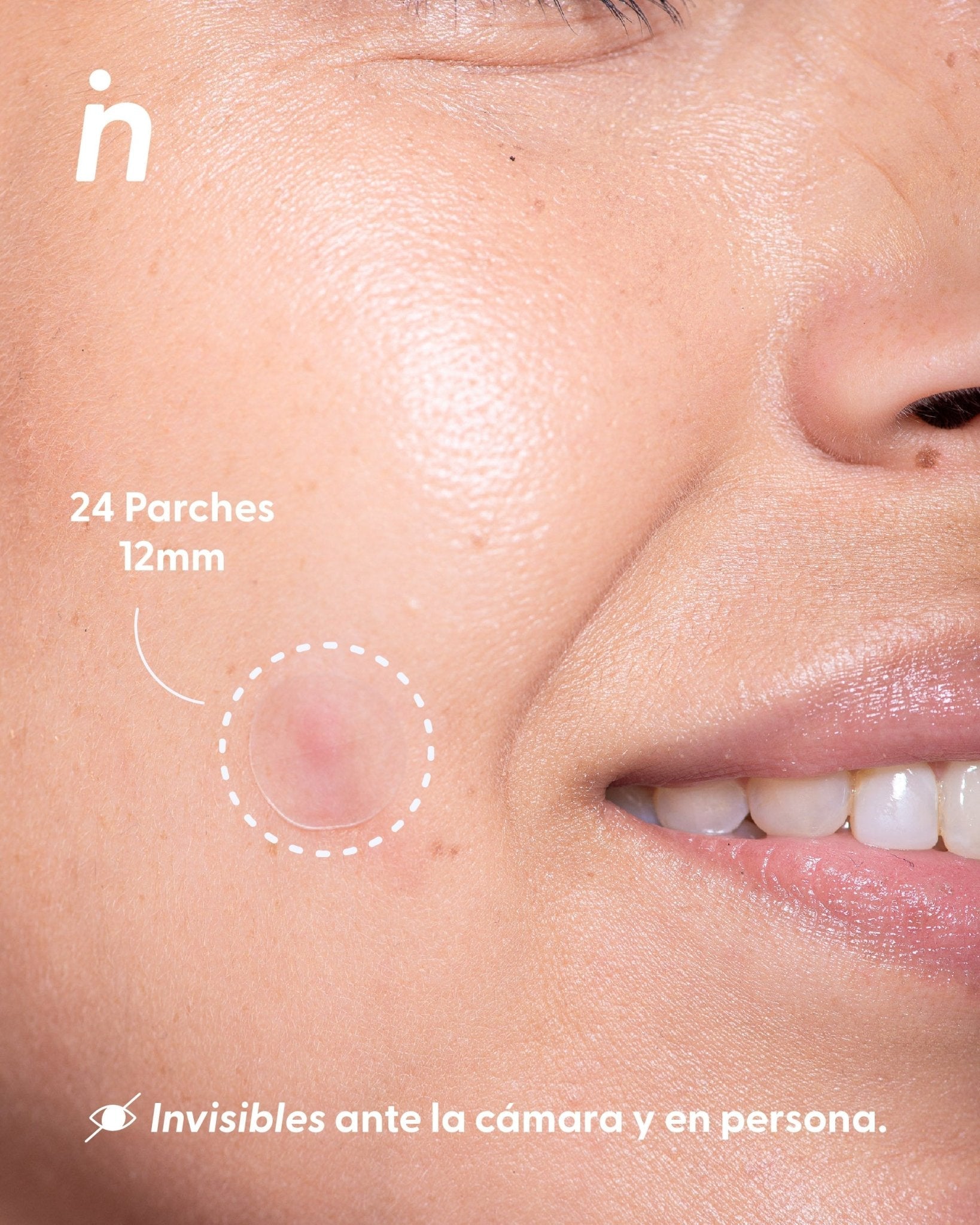 Parches de Hidrocoloide para Granitos - Nipskin®