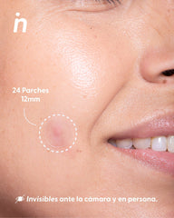 Parches para Granos, Pimple Patches  - Nipskin®