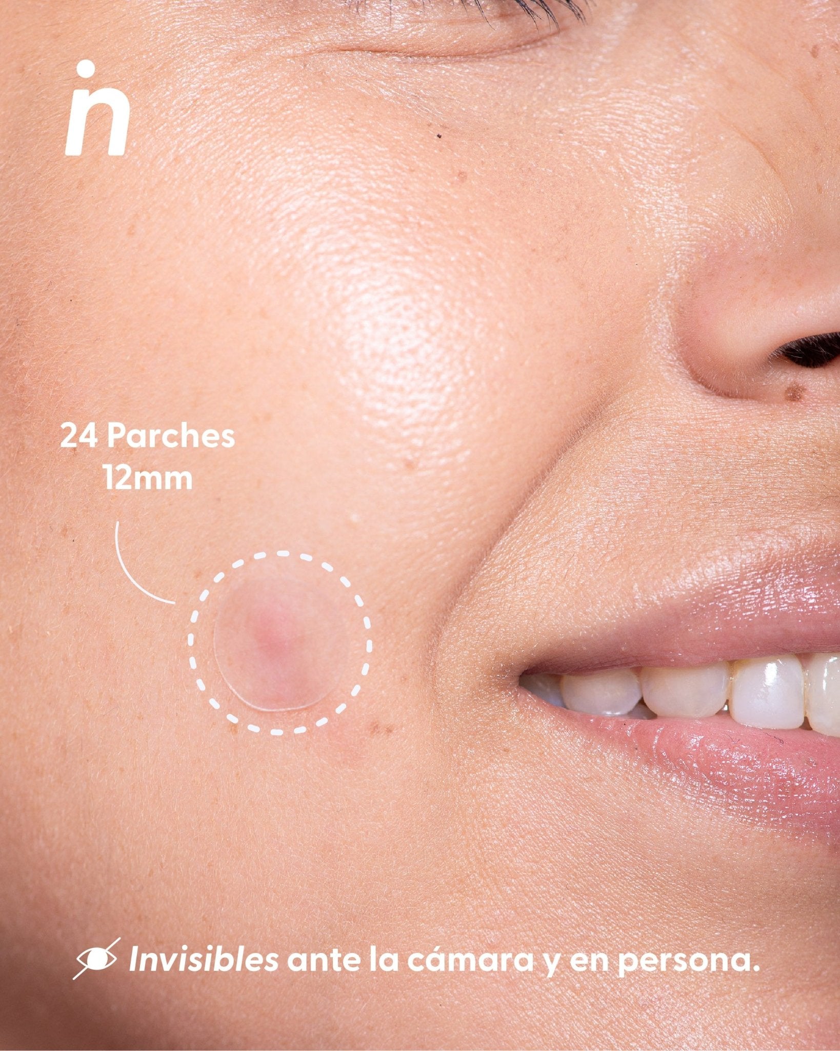 Parches para Granos, Pimple Patches - Nipskin® - Nipskin